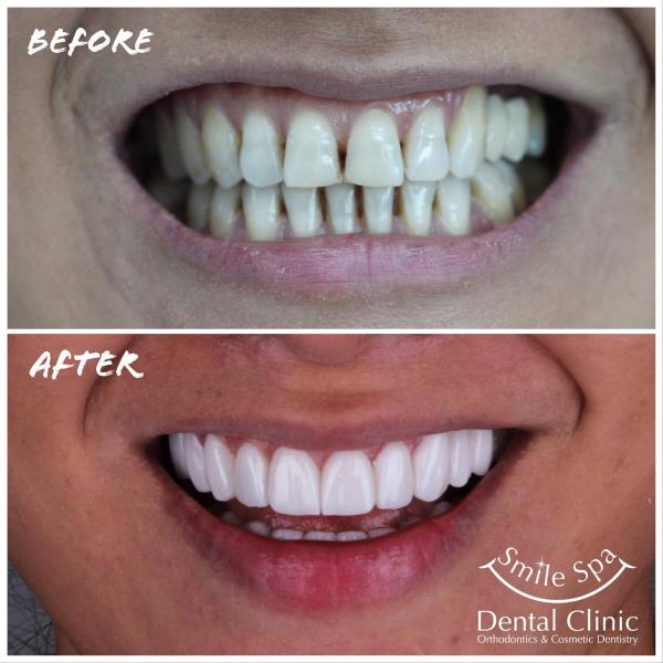 Qatar Smile Spa Dental Clinic Dubai Services Other, Find, Advertise